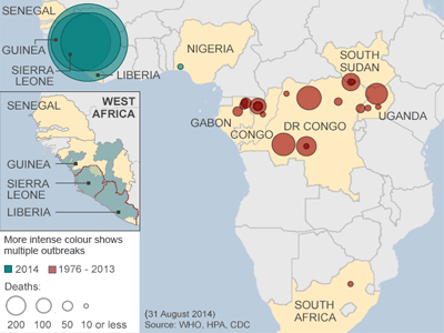 عفونت ویروسی ایبولا